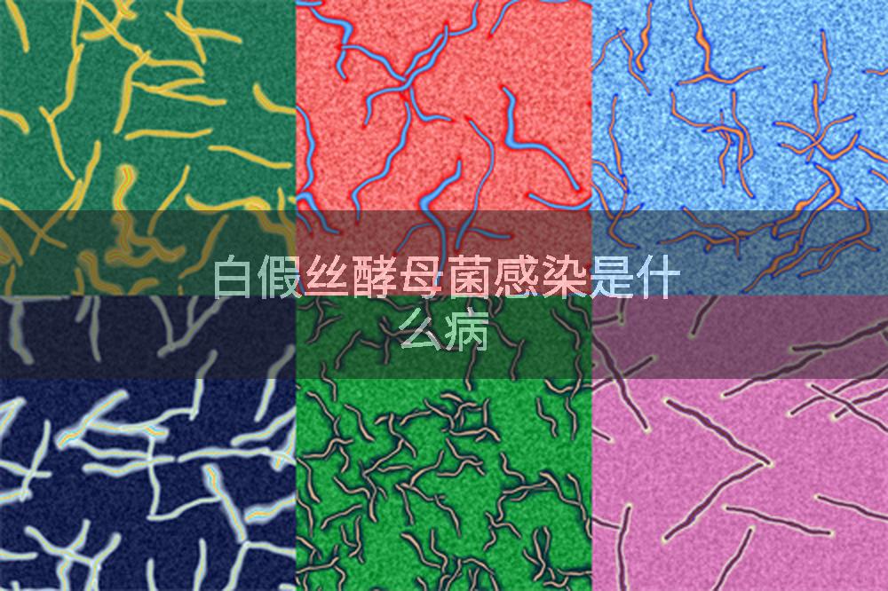 白假丝酵母菌感染是什么病
