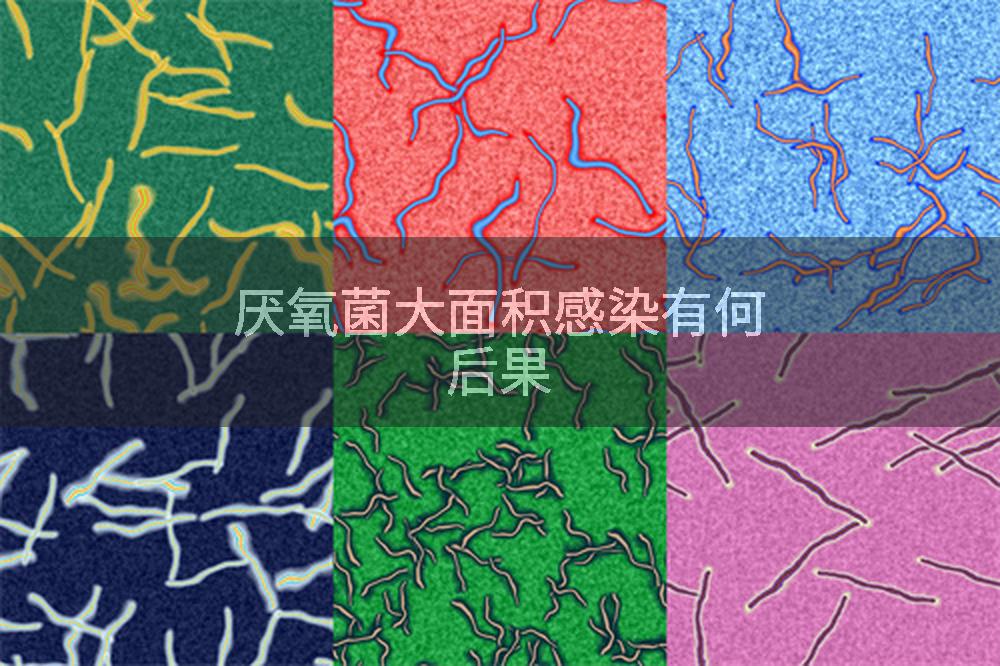厌氧菌大面积感染有何后果