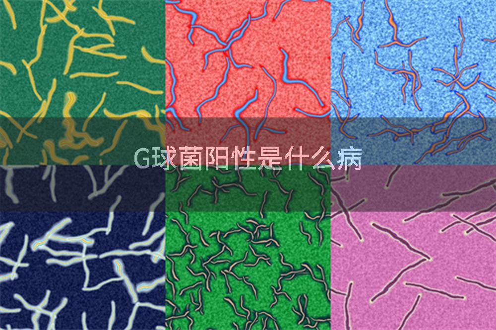 G球菌阳性是什么病