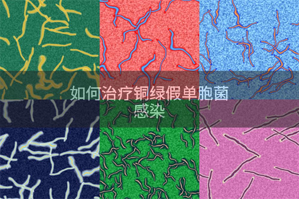 如何治疗铜绿假单胞菌感染