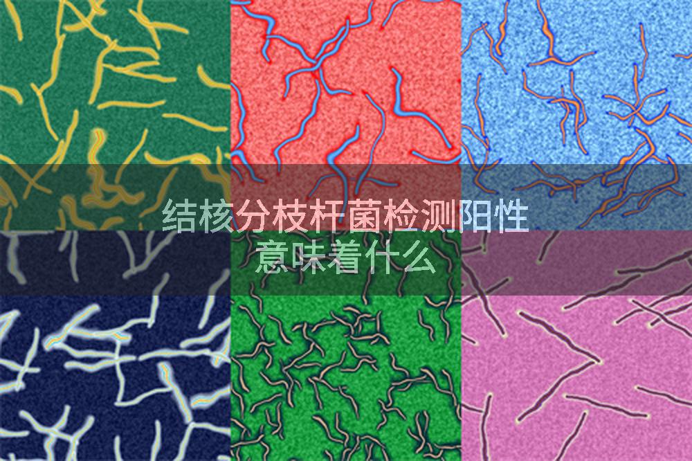 结核分枝杆菌检测阳性意味着什么