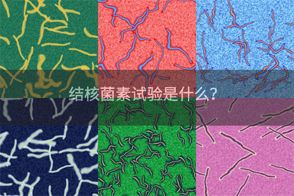 结核菌素试验是什么？
