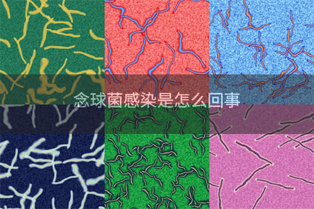 念球菌感染是怎么回事