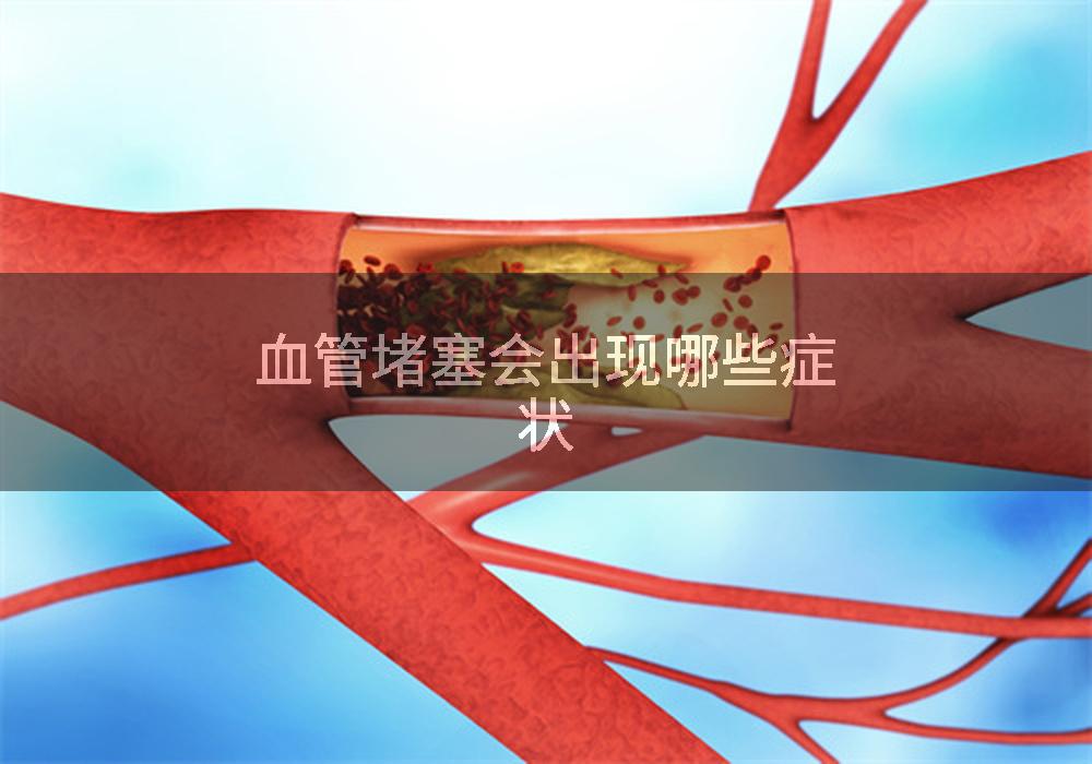 血管堵塞会出现哪些症状