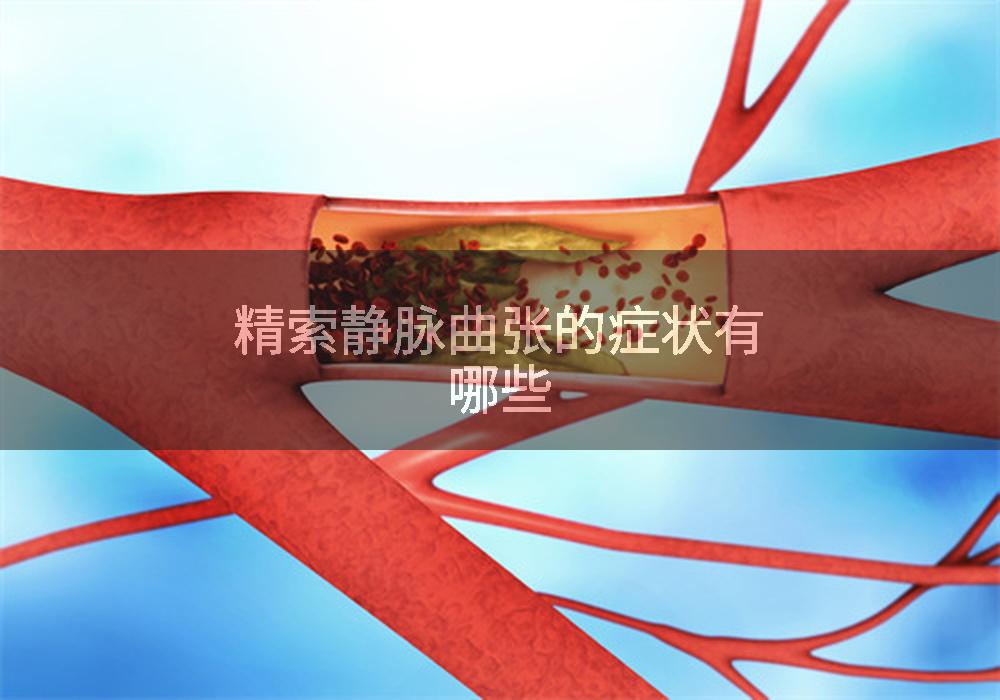 精索静脉曲张的症状有哪些
