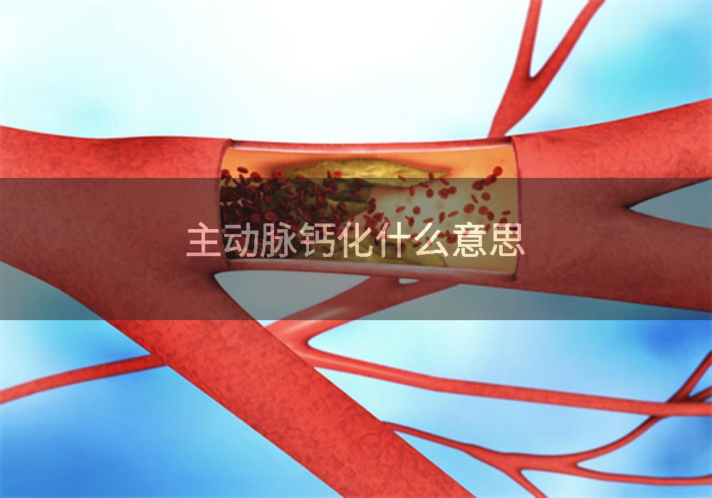 主动脉钙化什么意思