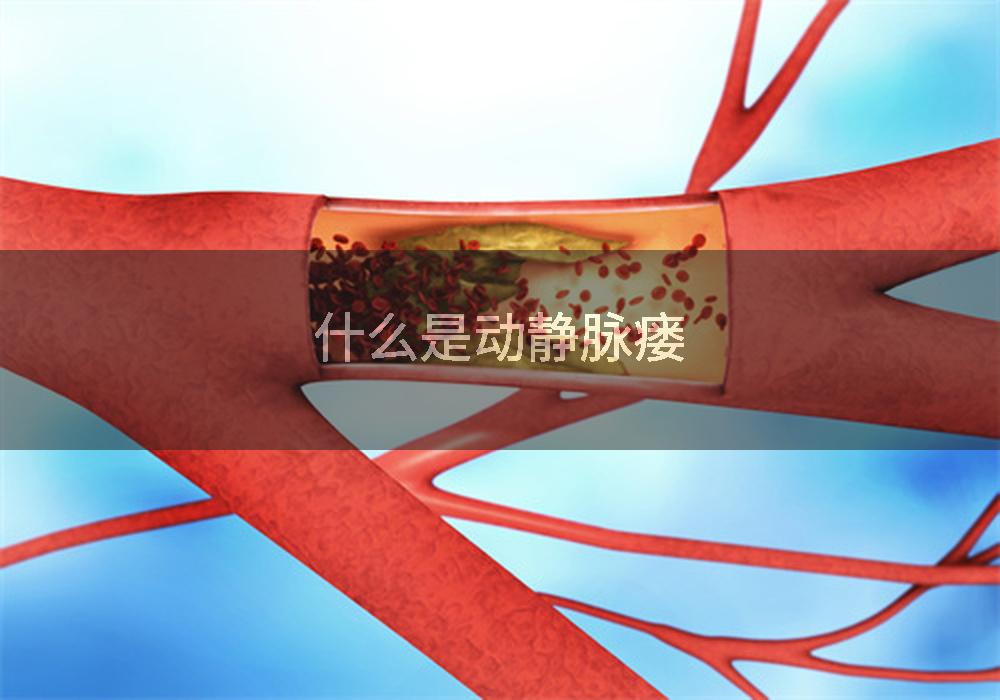 什么是动静脉瘘