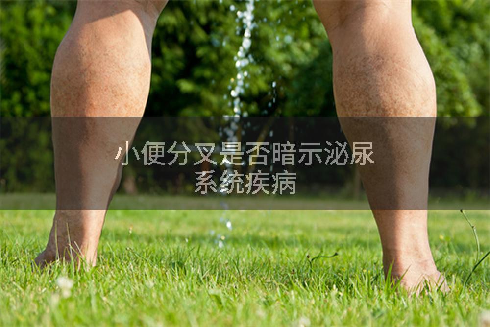 小便分叉是否暗示泌尿系统疾病