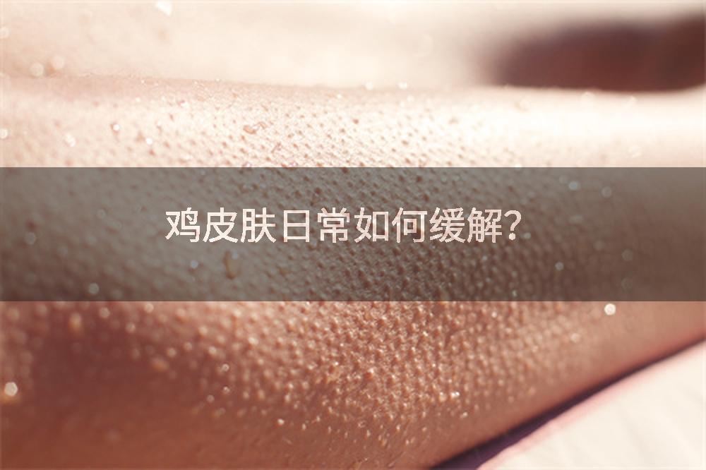 鸡皮肤日常如何缓解？