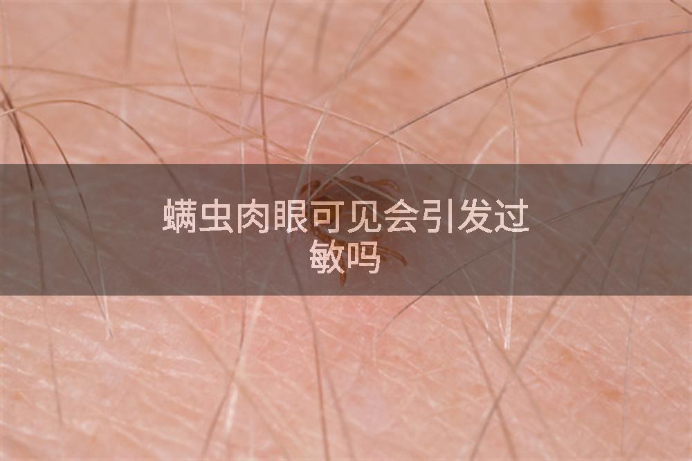 螨虫肉眼可见会引发过敏吗