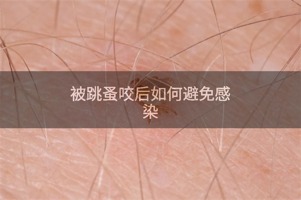 被跳蚤咬后如何避免感染