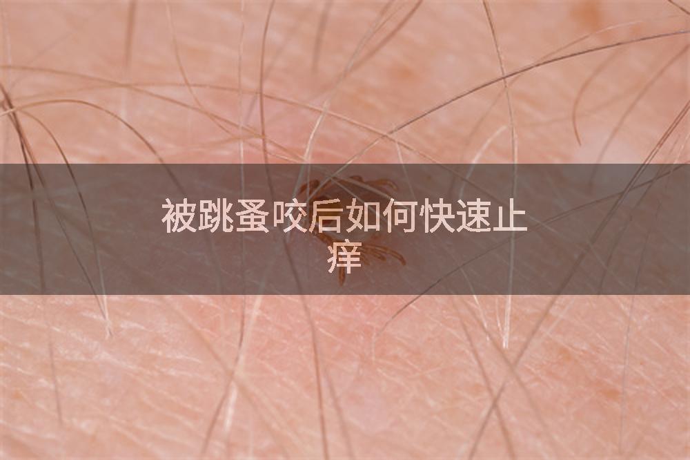 被跳蚤咬后如何快速止痒