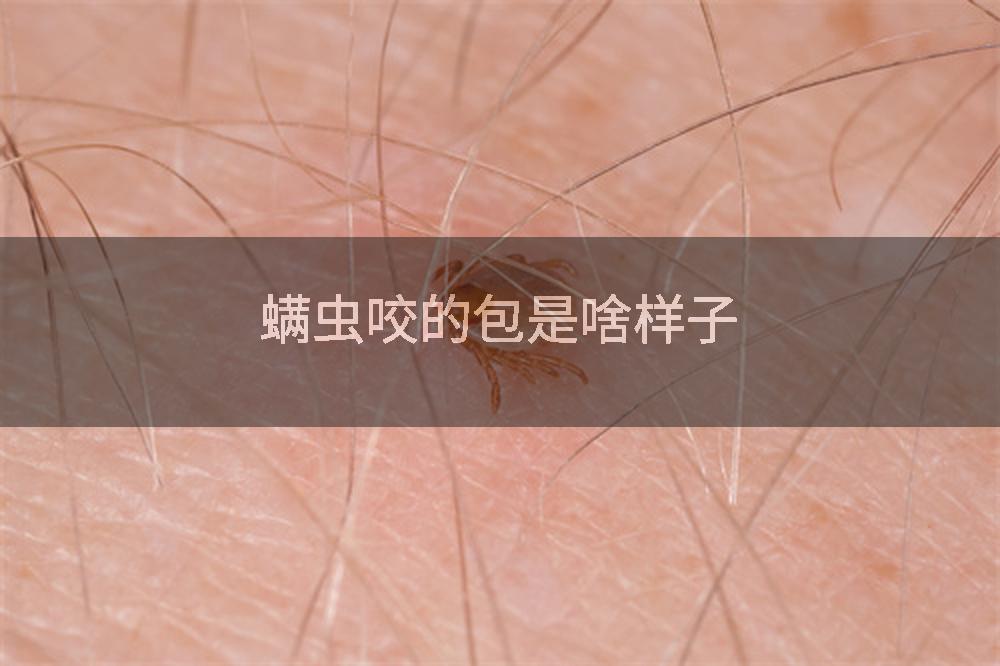 螨虫咬的包是啥样子