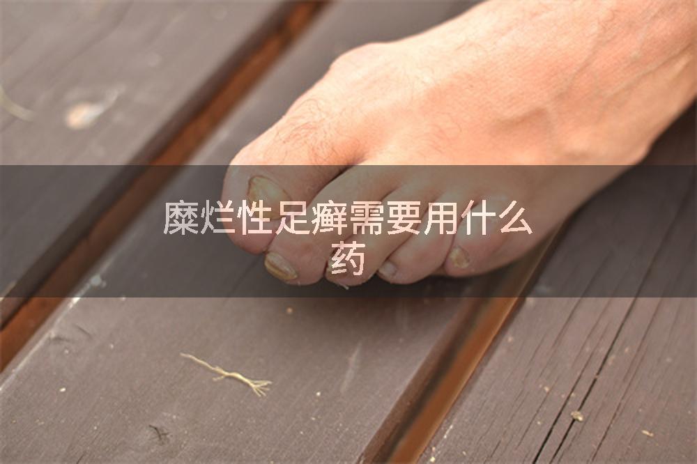 糜烂性足癣需要用什么药