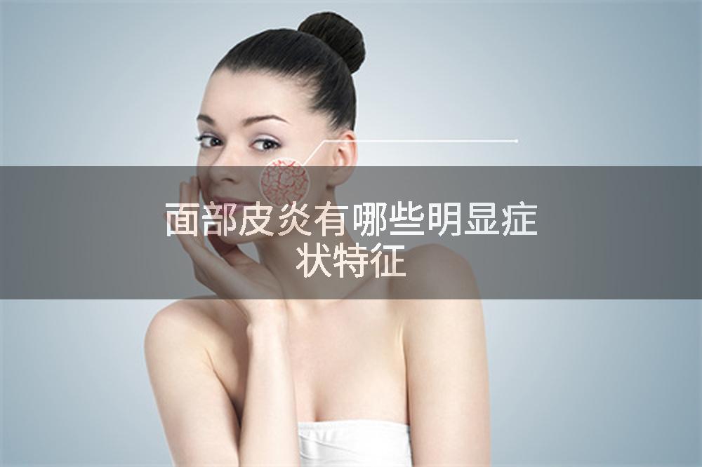 面部皮炎有哪些明显症状特征