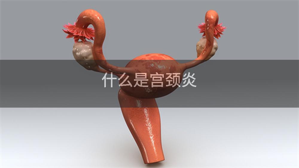 什么是宫颈炎