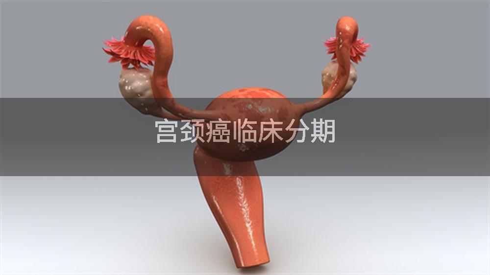 宫颈癌临床分期