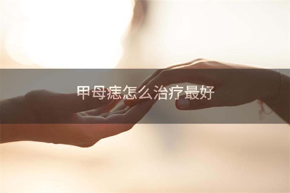 甲母痣怎么治疗最好