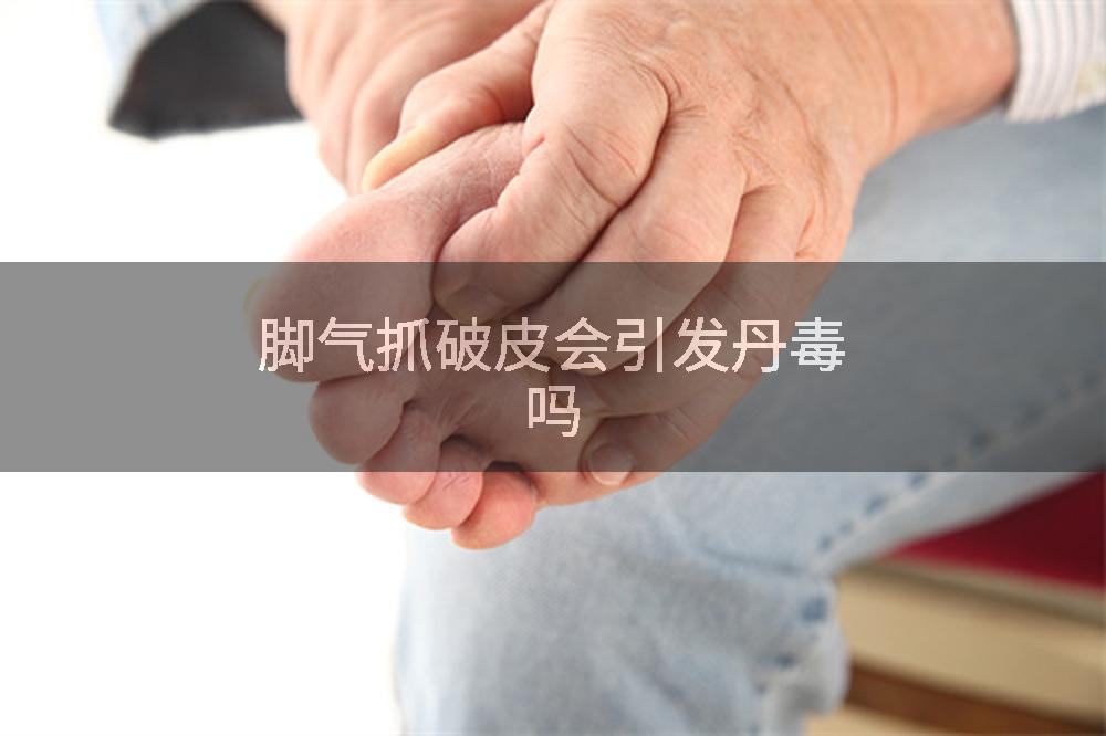 脚气抓破皮会引发丹毒吗