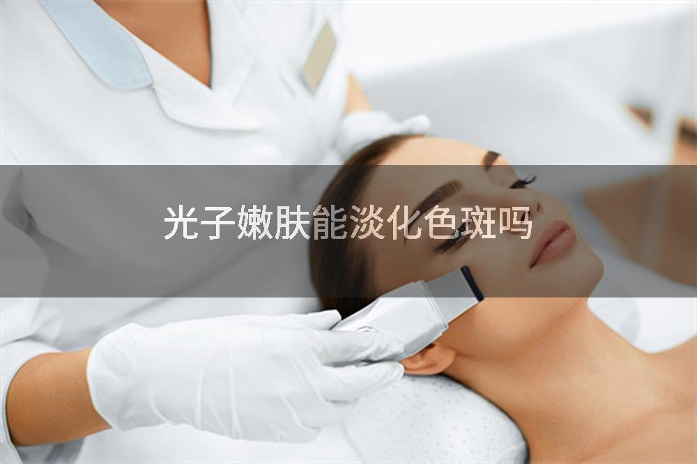 光子嫩肤能淡化色斑吗