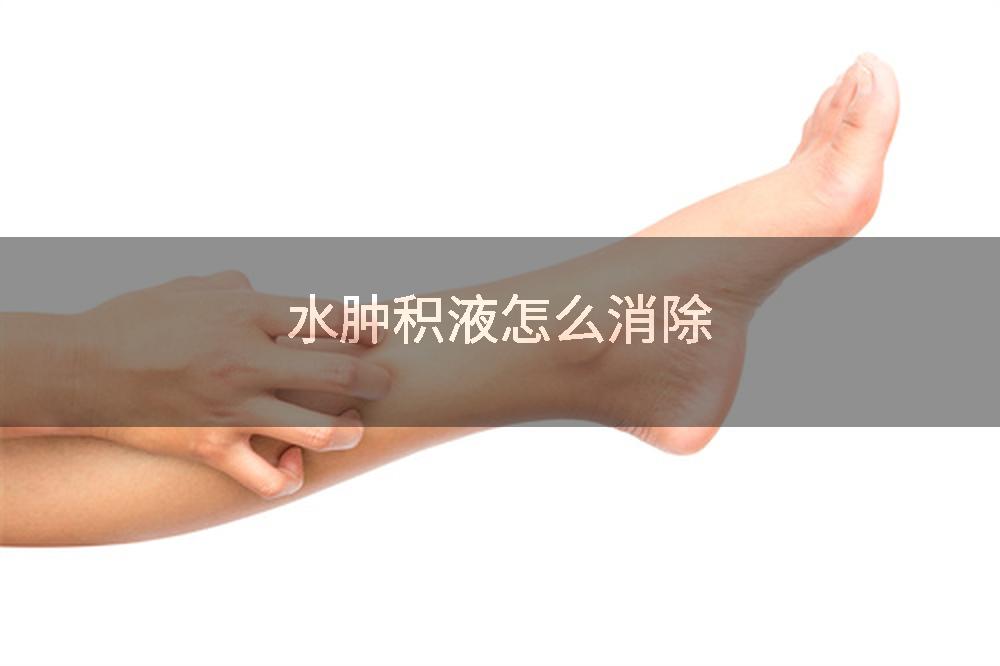 水肿积液怎么消除