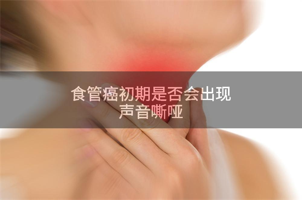 食管癌初期是否会出现声音嘶哑