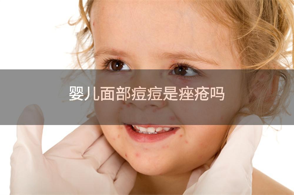 婴儿面部痘痘是痤疮吗
