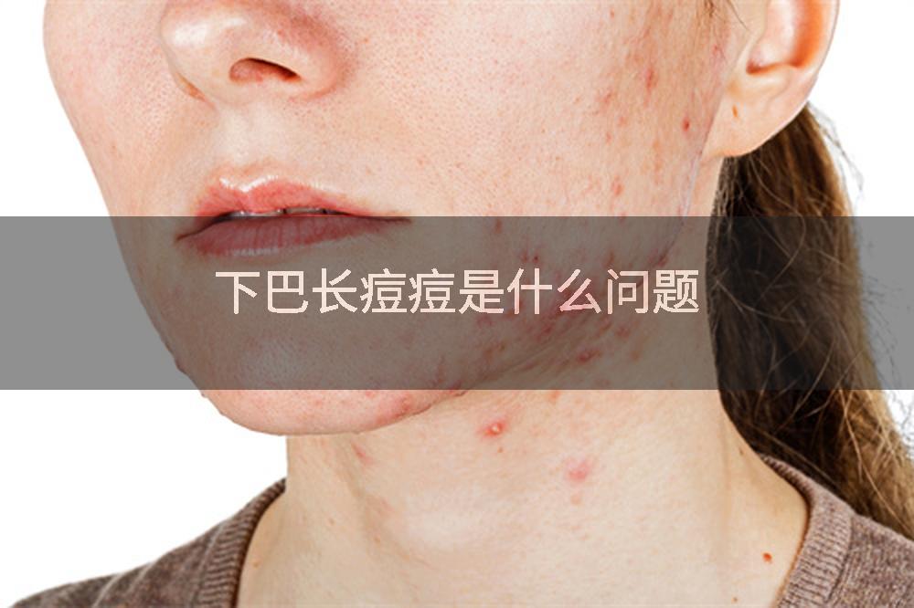 下巴长痘痘是什么问题