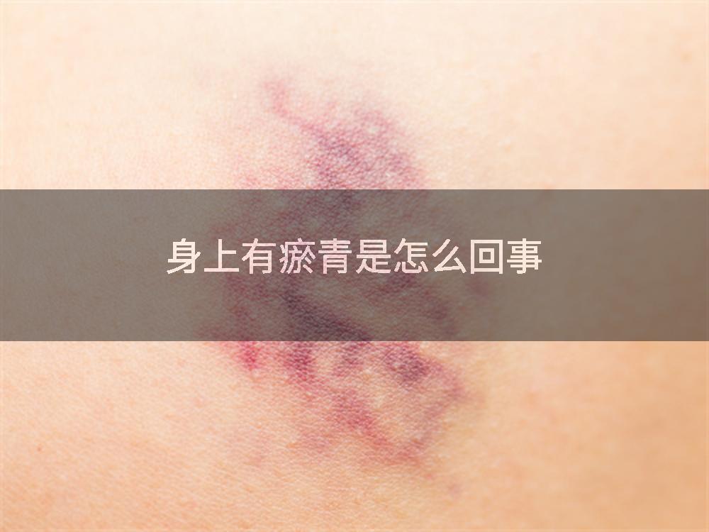 身上有瘀青是怎么回事