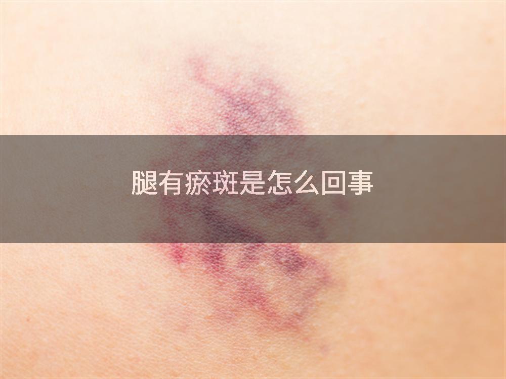 腿有瘀斑是怎么回事