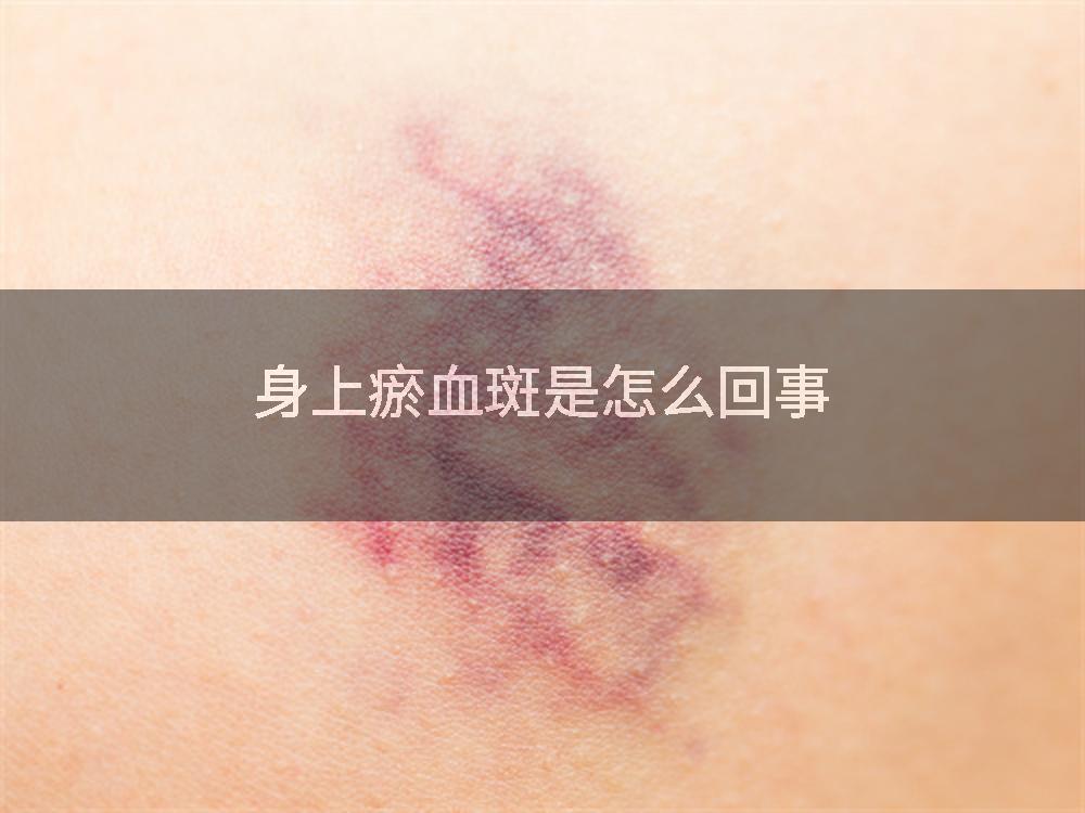 身上瘀血斑是怎么回事