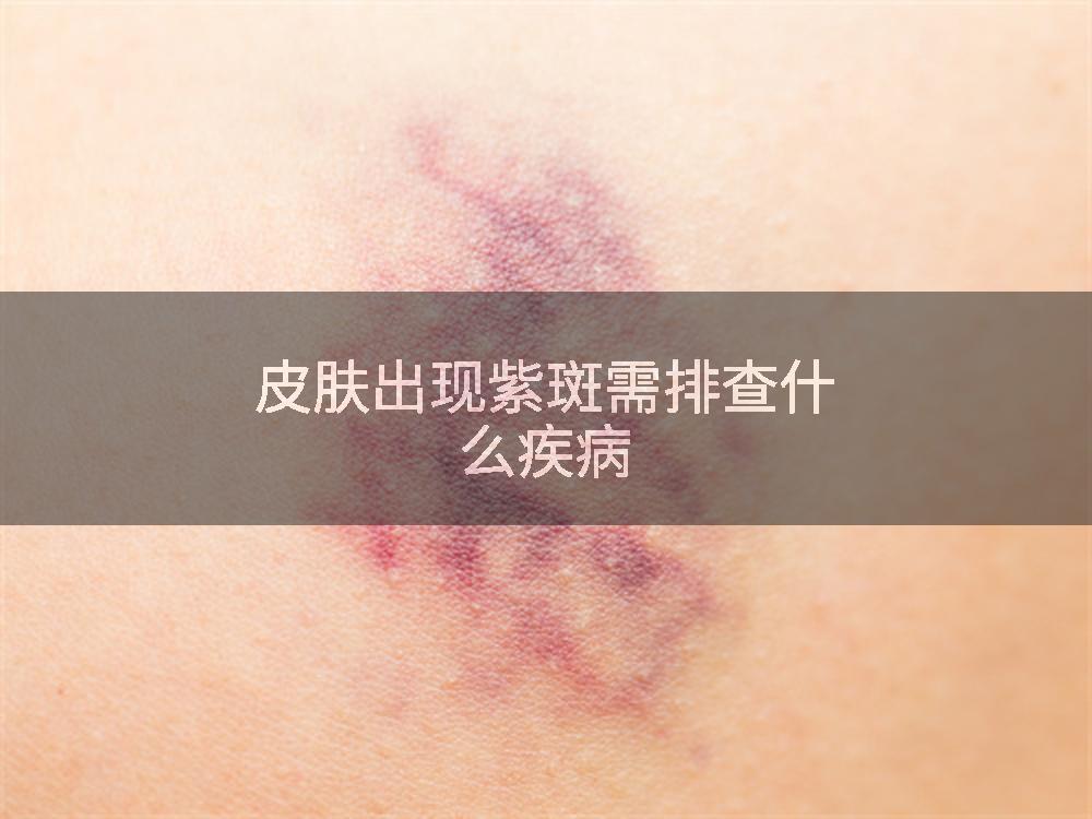 皮肤出现紫斑需排查什么疾病