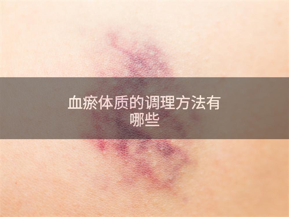 血瘀体质的调理方法有哪些