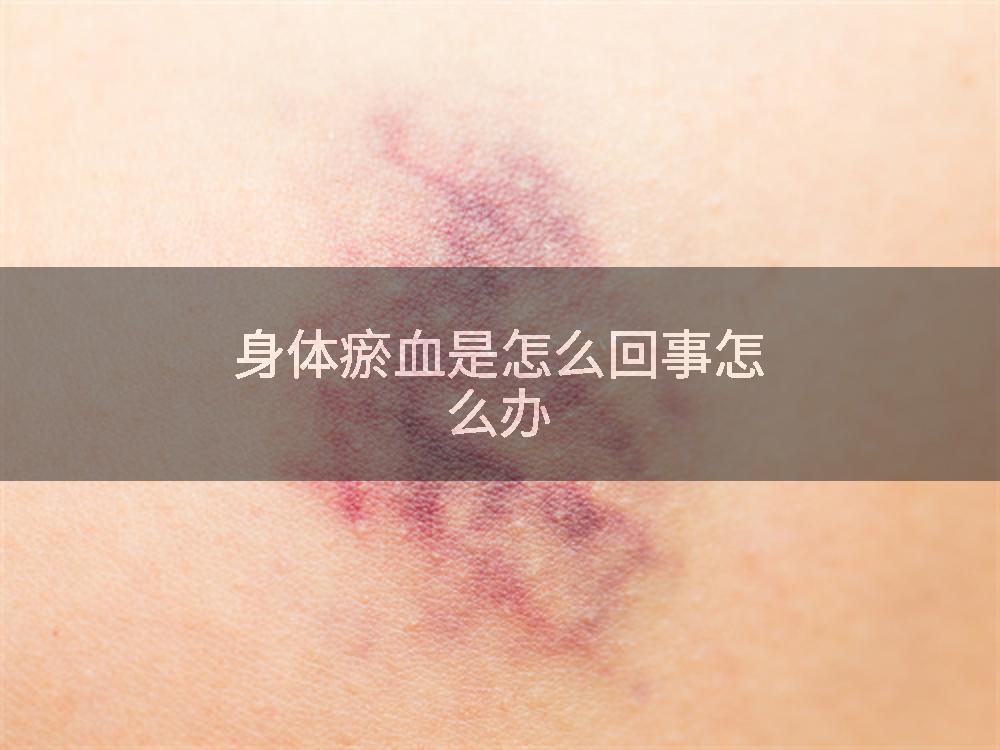 身体瘀血是怎么回事怎么办