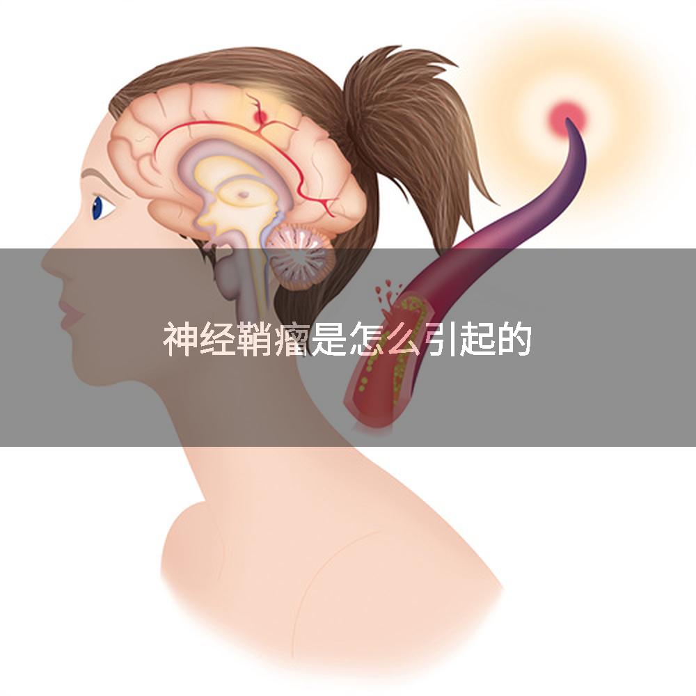 神经鞘瘤是怎么引起的