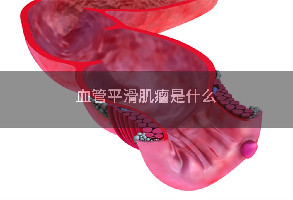血管平滑肌瘤是什么