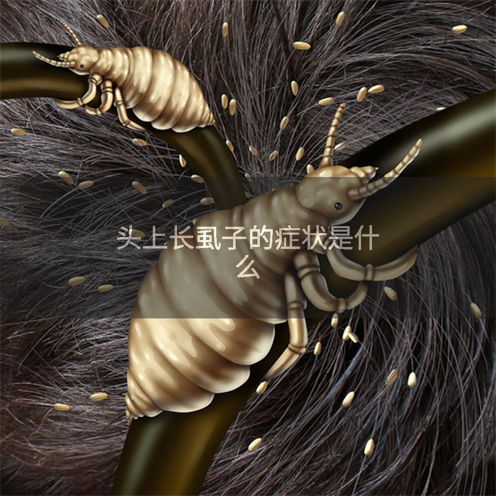 头上长虱子的症状是什么