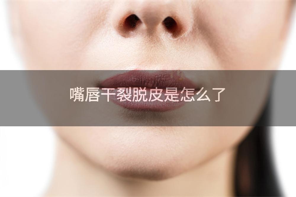 嘴唇干裂脱皮是怎么了