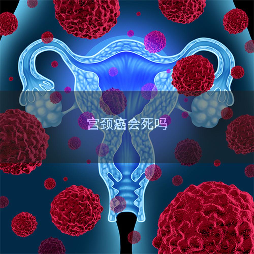 宫颈癌会死吗