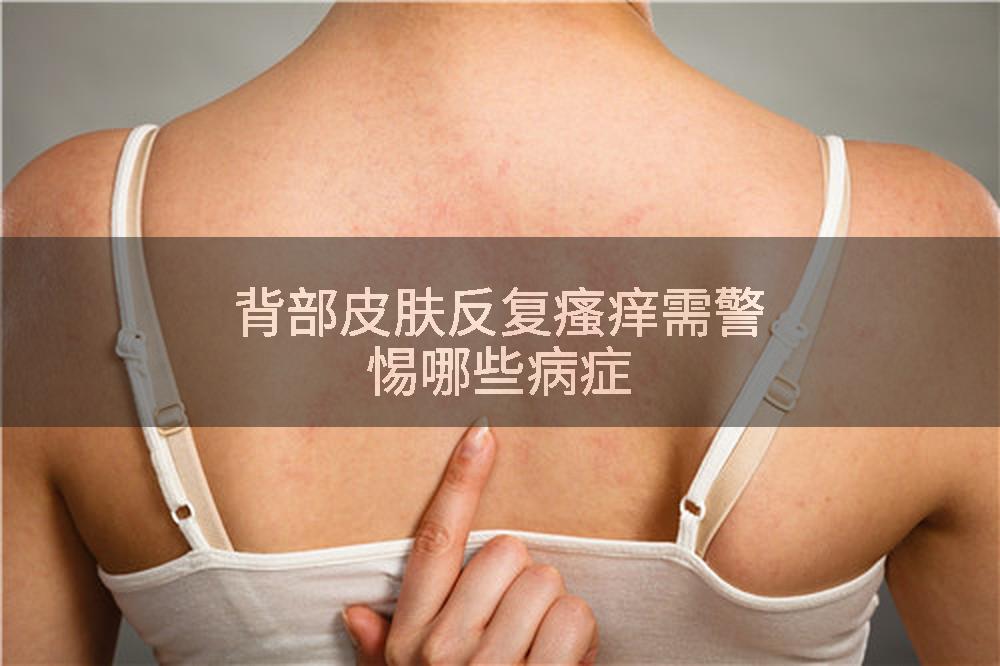 背部皮肤反复瘙痒需警惕哪些病症