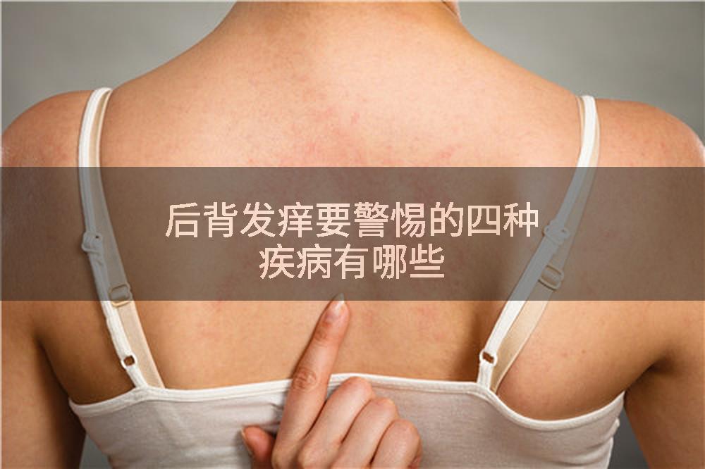 后背发痒要警惕的四种疾病有哪些