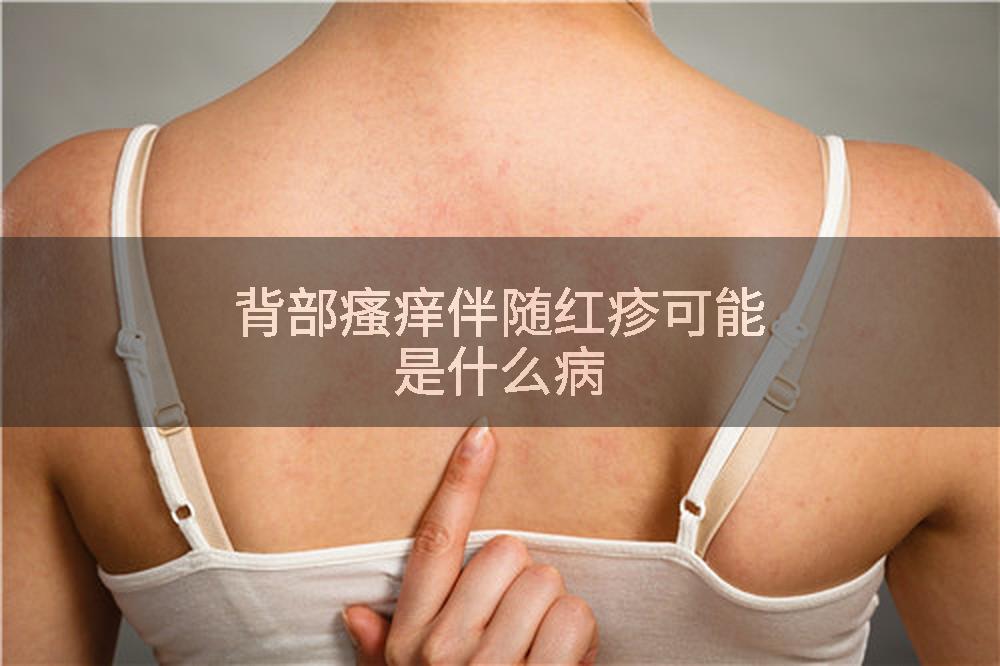 背部瘙痒伴随红疹可能是什么病