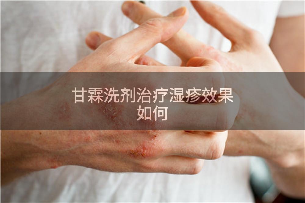 甘霖洗剂治疗湿疹效果如何