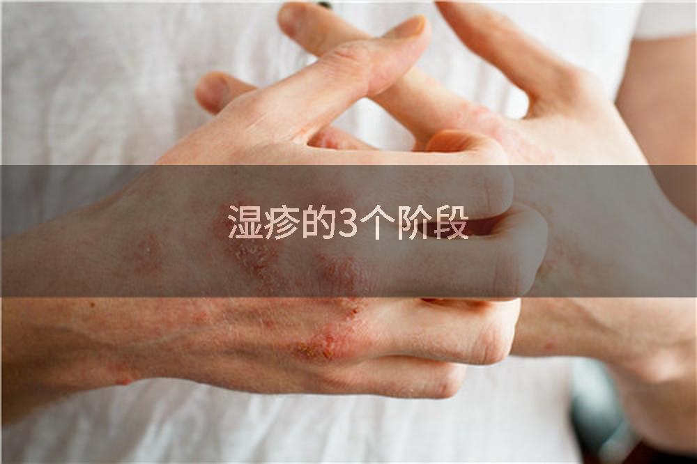 湿疹的3个阶段