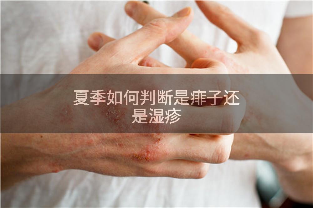 夏季如何判断是痱子还是湿疹