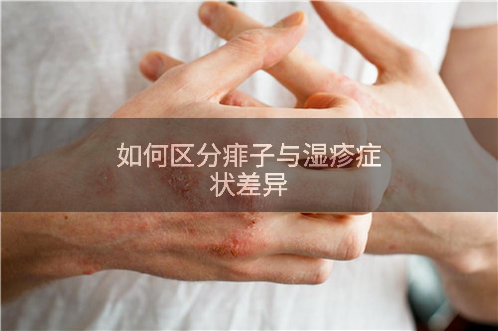 如何区分痱子与湿疹症状差异