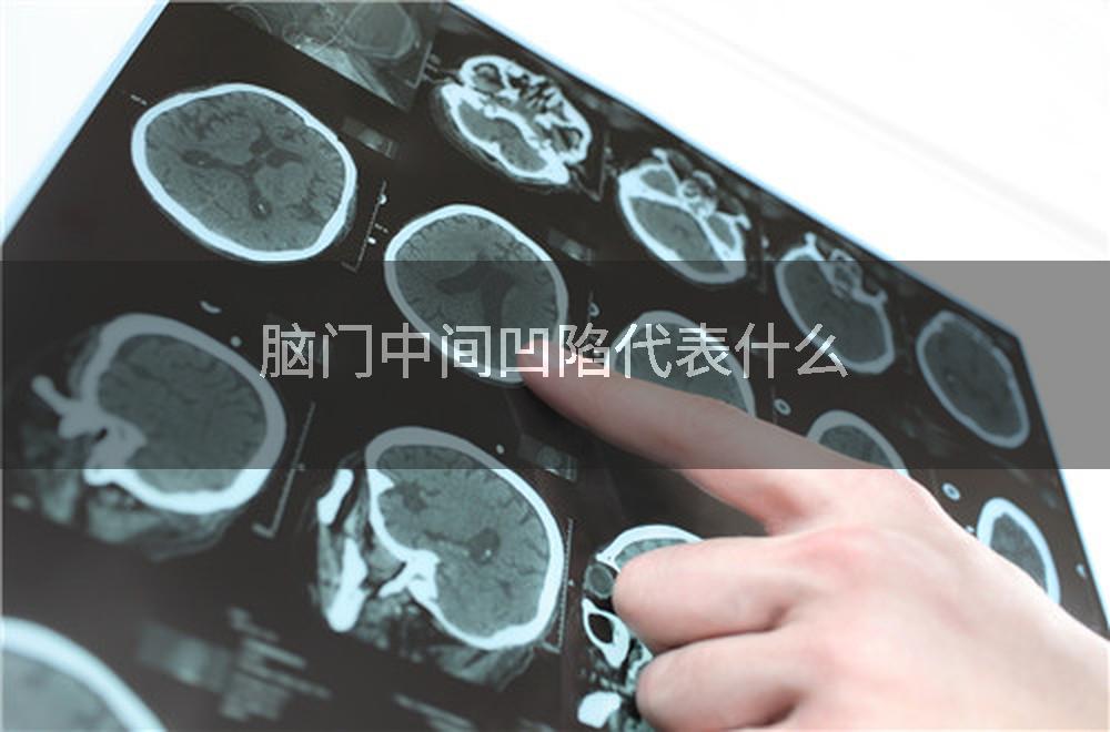 脑门中间凹陷代表什么