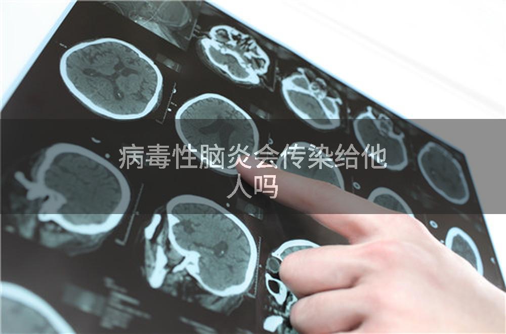 病毒性脑炎会传染给他人吗