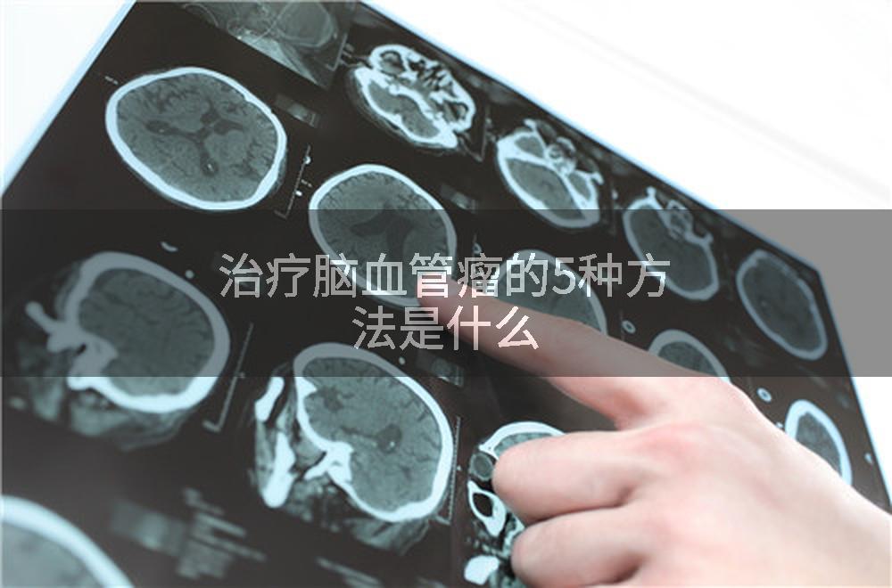 治疗脑血管瘤的5种方法是什么
