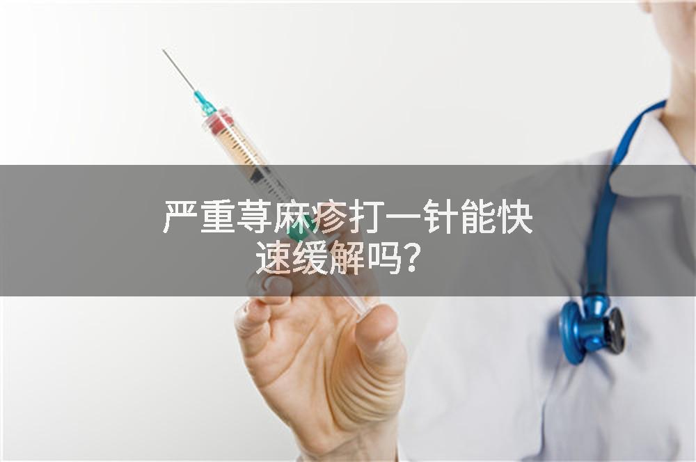 严重荨麻疹打一针能快速缓解吗？